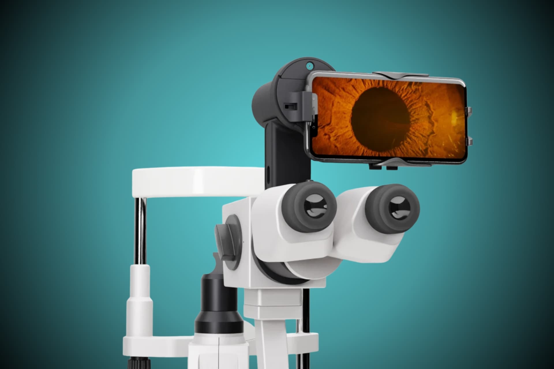 Remidio Anterior Segment Imaging System used at Dr. Murkute's O2 Bone & Eye Care Clinic, Kharadi, Pune