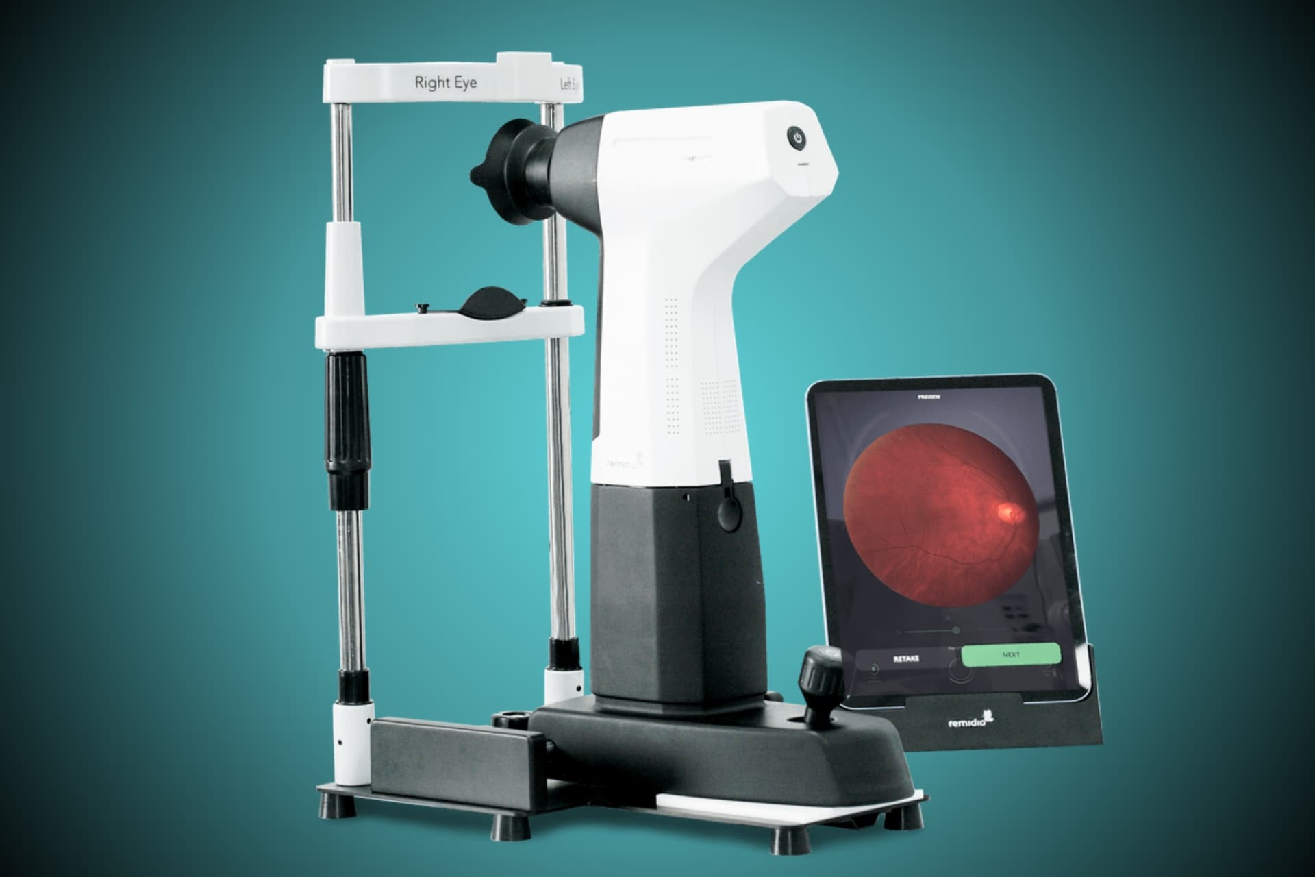Remidio Fundus Camera used at Dr. Murkute's O2 Bone & Eye Care Clinic, Kharadi, Pune